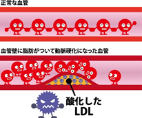動脈硬化を防ぐ食事について 血液をサラサラに 配食のふれ愛 動脈硬化を防ぐ食事について 血液をサラサラに 配食のふれ愛