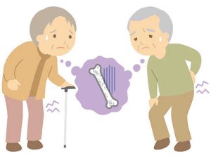 骨密度が低下するとどんな影響がある？